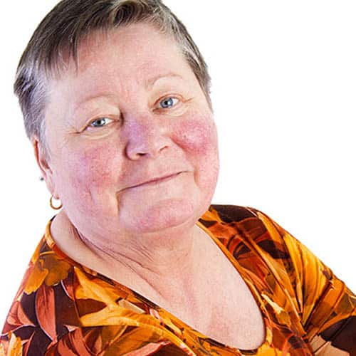 Treatment for Rosacea in Pittsburgh